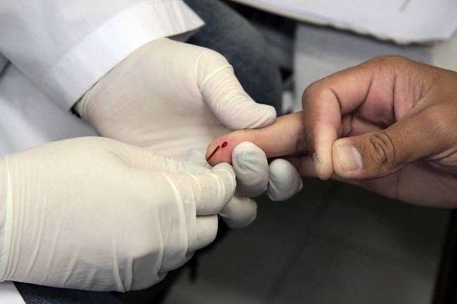 Faça teste de hepatite C no Terminal Diadema
